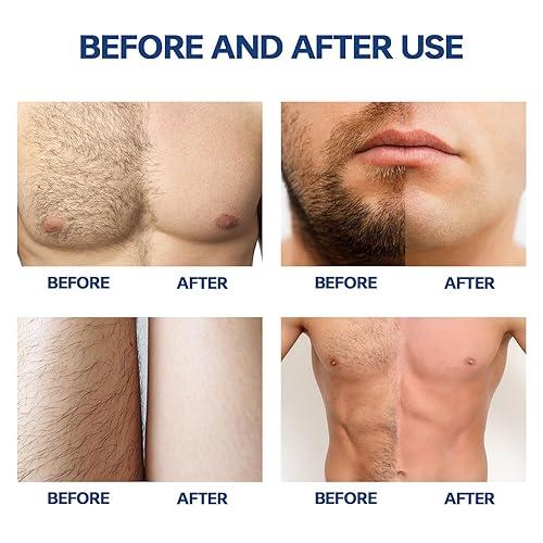 Glame Hair Removal Spray for Men and Women - Rumaisas