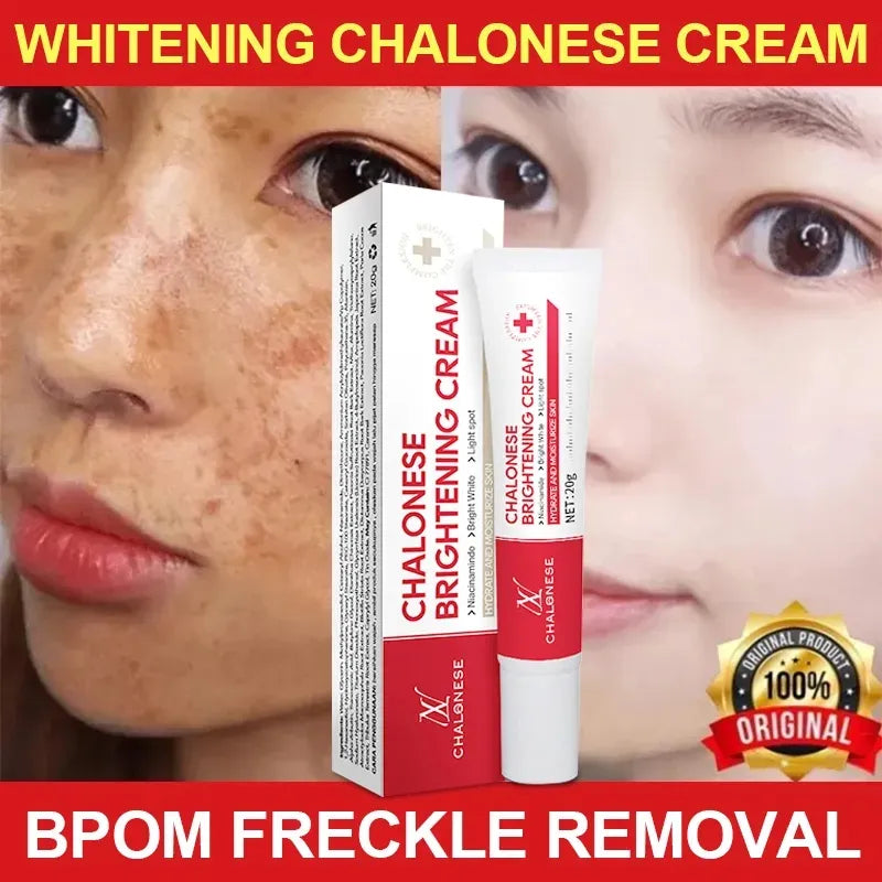 Chalonese Brightening Cream in Pakistan