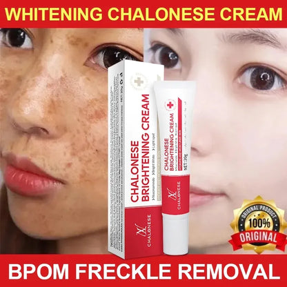Chalonese Brightening Cream in Pakistan